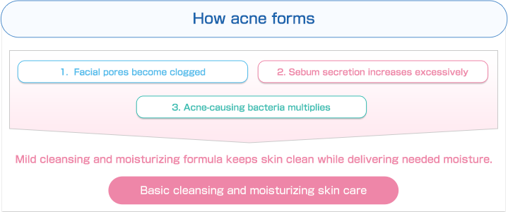 How acne forms | 1. Facial pores become clogged | 2. Sebum secretion increases excessively | 3. Acne-causing bacteria multiplies | Mild cleansing and moisturizing formula keeps skin clean while delivering needed moisture. | Basic cleansing and moisturizing skin care.