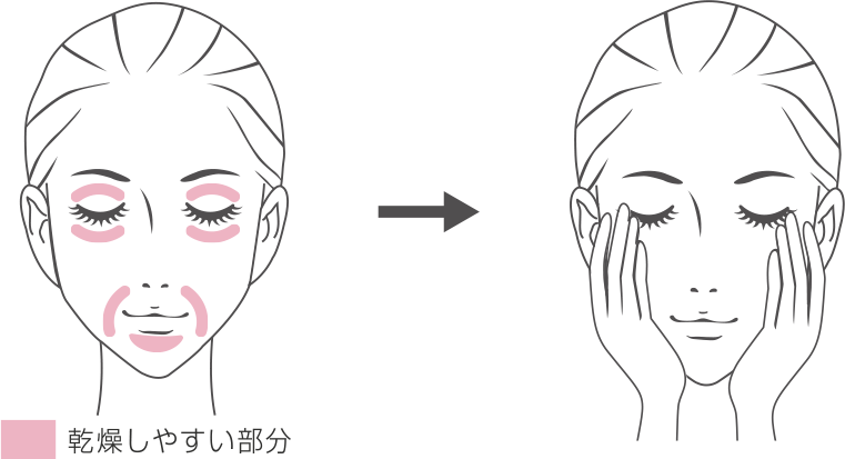目もとや口もとなど乾燥しやすい部分を示した女性の顔のイラストと、手のひら全体で顔をつつみこむようにニキビ（にきび）肌用化粧水（ローション）をフェイスラインになじませて、アクネケアをする女性の顔のイラスト。