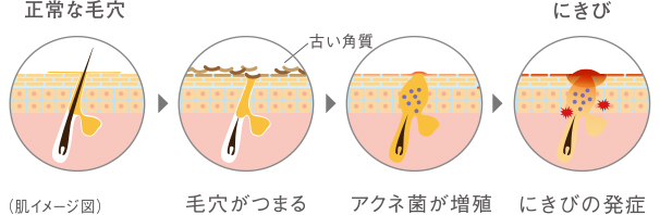 大人のにきび肌のための機能重視の積極ケア ノブACアクティブシリーズ