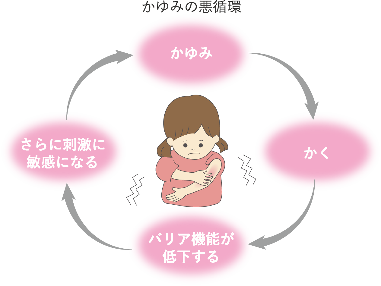 敏感肌 乾燥肌は特にかさつきがちな冬 全身用保湿クリームでうるおいを保つポイント ノブ公式ブランドサイト